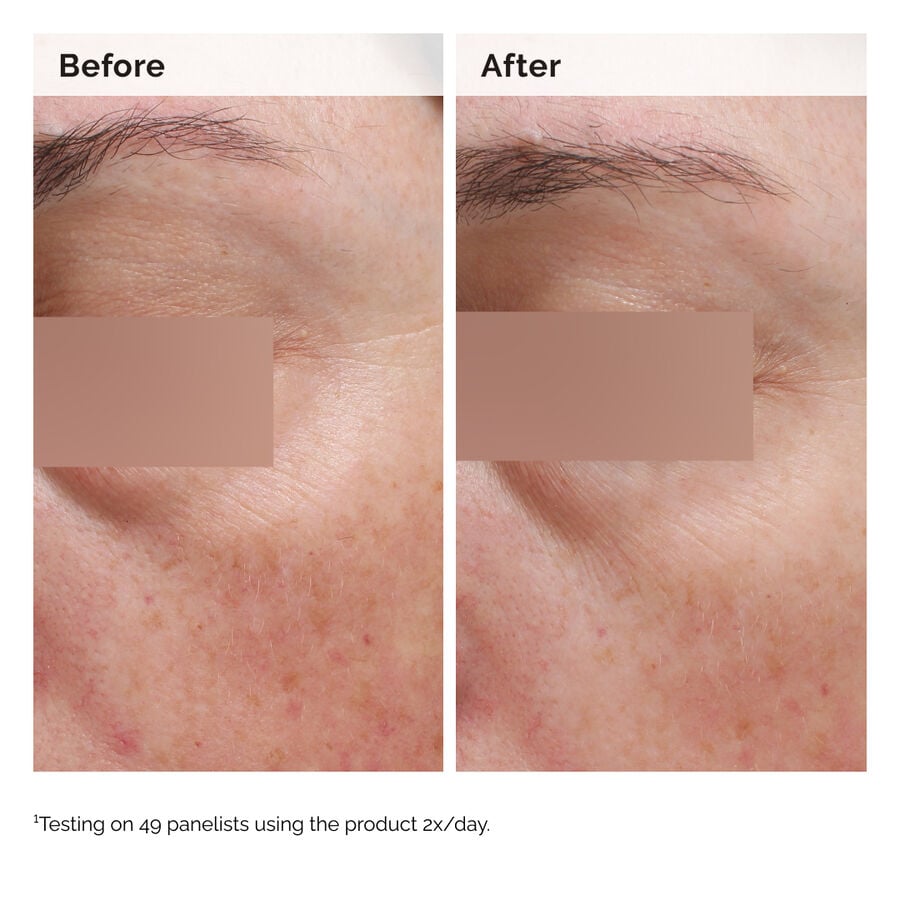 niacinamide-5-face-and-body-emulsion-z5 2024-08-23-ORD-Nia-5pct-Face-Body-B-A-Elasticity-Global-02-1x1.jpg
