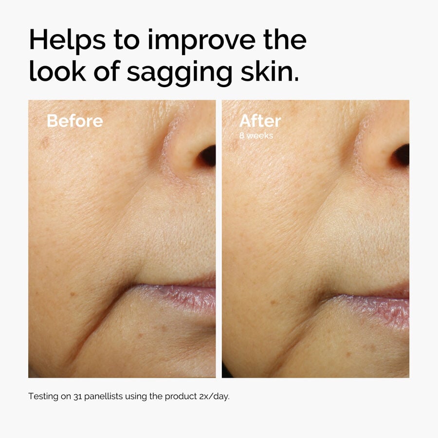 caffeine-3-escin-1-face-serum-k4 ord-caffeine-3pct-escin-1pct-face-serum-before-after-sagging.jpg