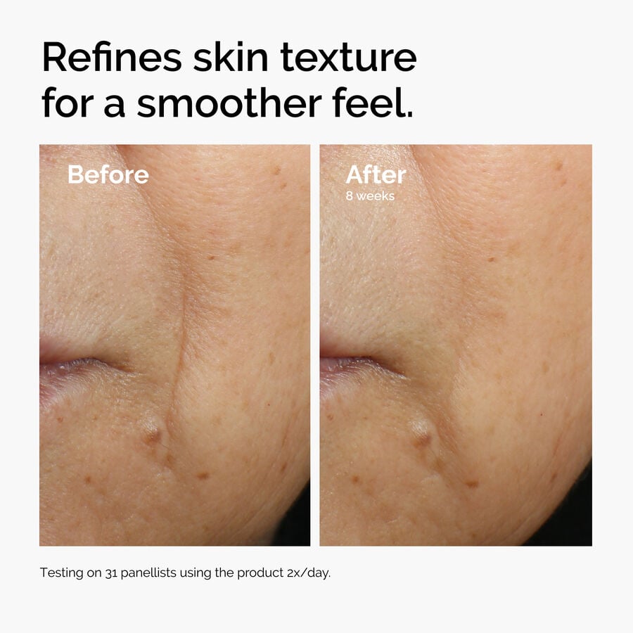 caffeine-3-escin-1-face-serum-k4 ord-caffeine-3pct-escin-1pct-face-serum-before-after-texture.jpg