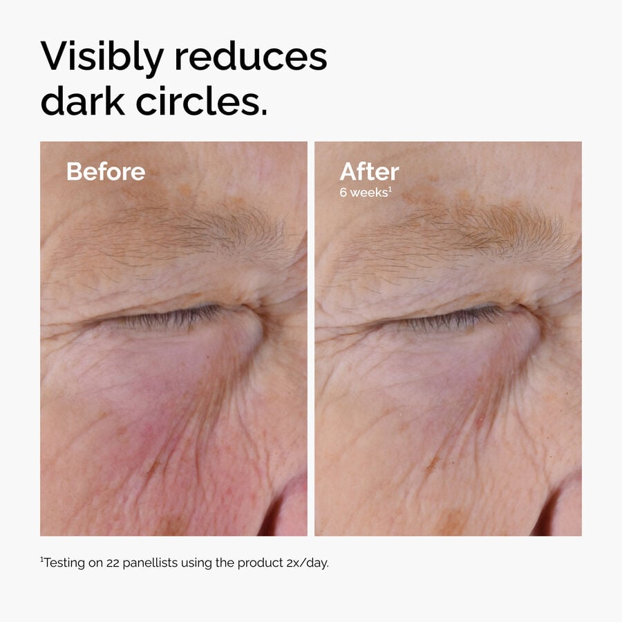 caffeine-solution-5-egcg-eye-serum-t3 ord-caffeine-solution-egcg-dark-circles-before-after.jpg