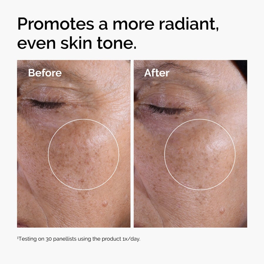 glycolic-acid-7-exfoliating-toner-u7 ord-glycolic-before-after-radiance.jpg