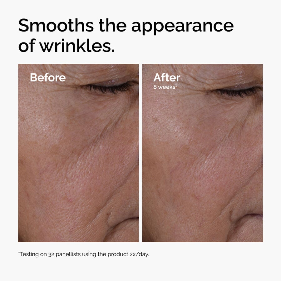 multi-peptide-ha-serum-g5 ord-multi-peptide-ha-serum-wrinkles-before-after.jpg