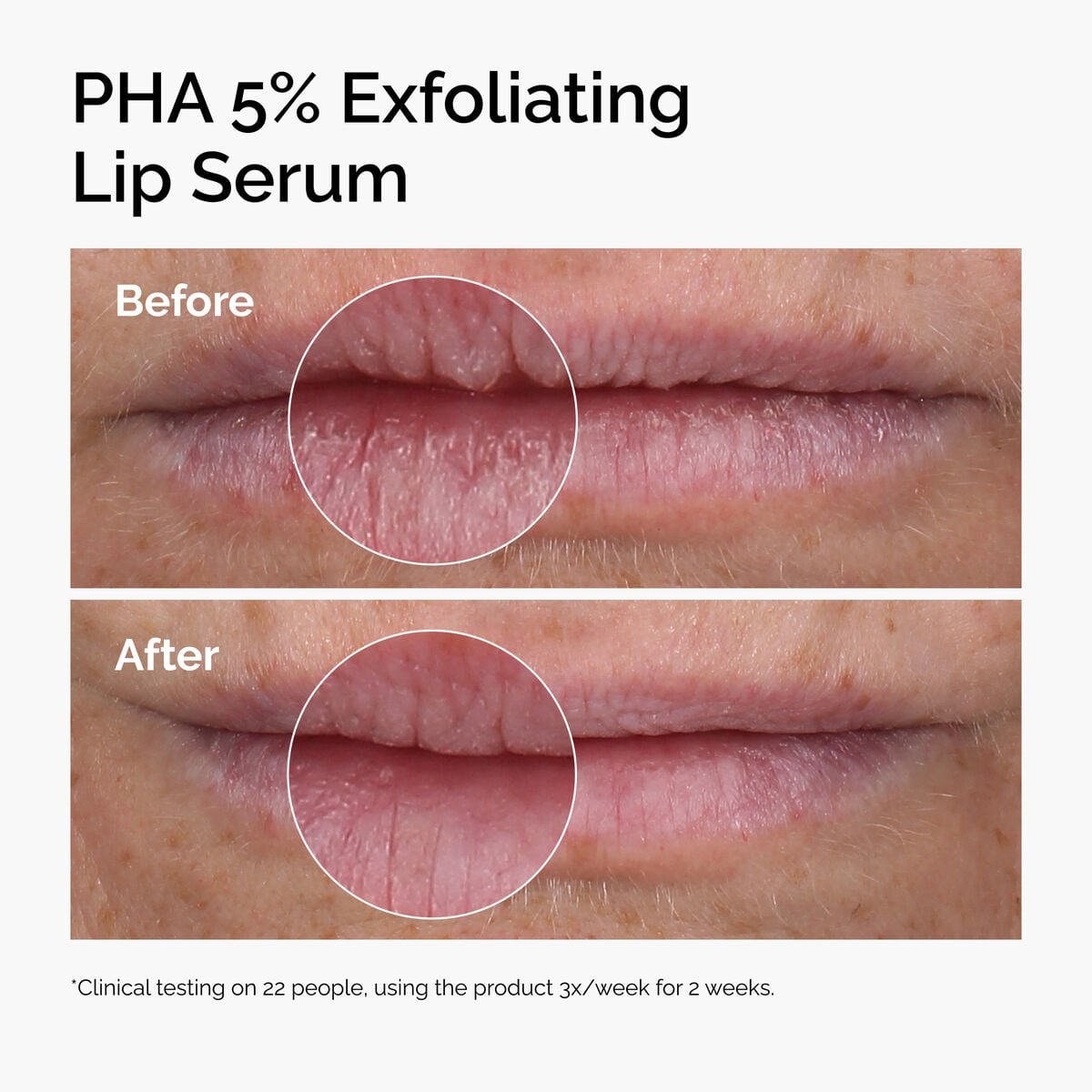 pha-5-exfoliating-lip-serum-y4 ord-pha-5pct-lip-exfoliating-serum-before-after.jpg