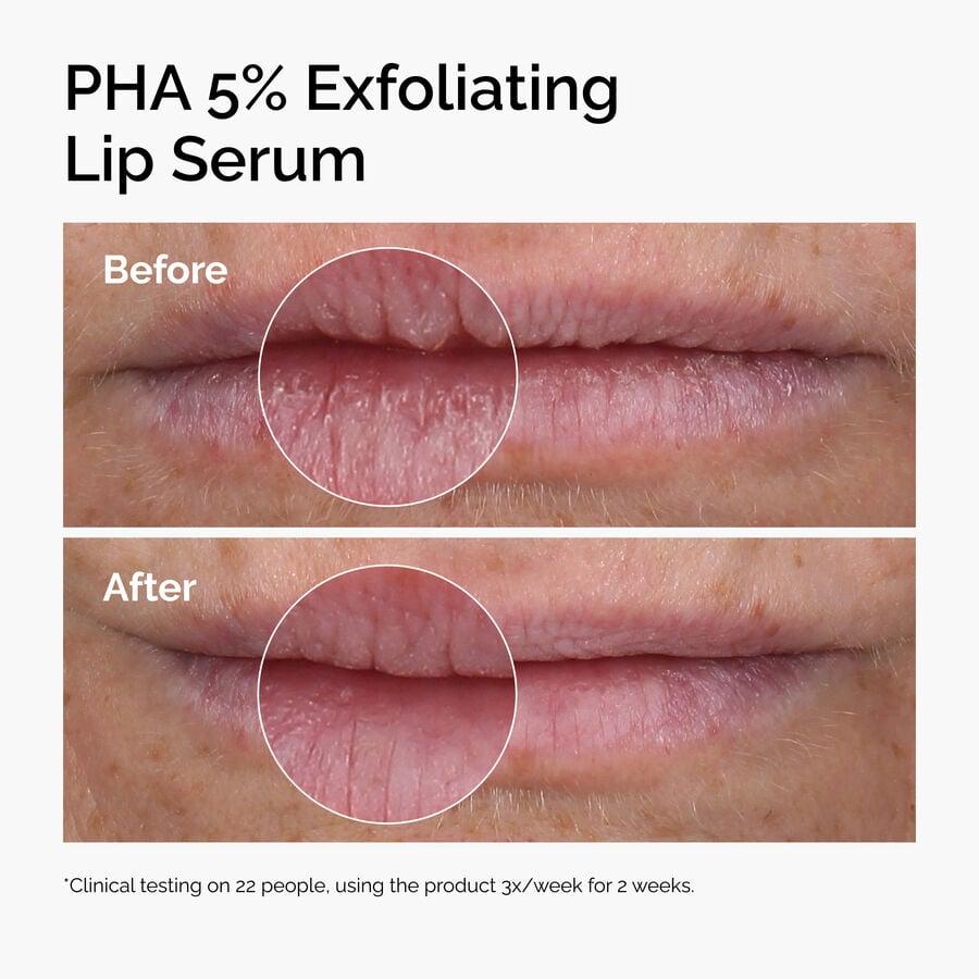 pha-5-exfoliating-lip-serum-y4 ord-pha-5pct-lip-exfoliating-serum-before-after.jpg